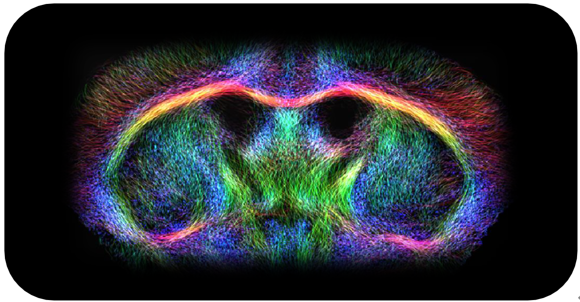 小鼠腦部擴(kuò)散張量成像.png 小鼠腦部擴(kuò)散張量成像.png