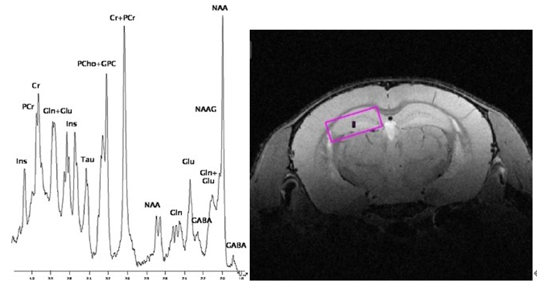 高強(qiáng)磁場(chǎng)下的磁共振波譜.png 高強(qiáng)磁場(chǎng)下的磁共振波譜.png