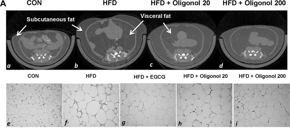 肥胖機制研究.png 肥胖機制研究.png