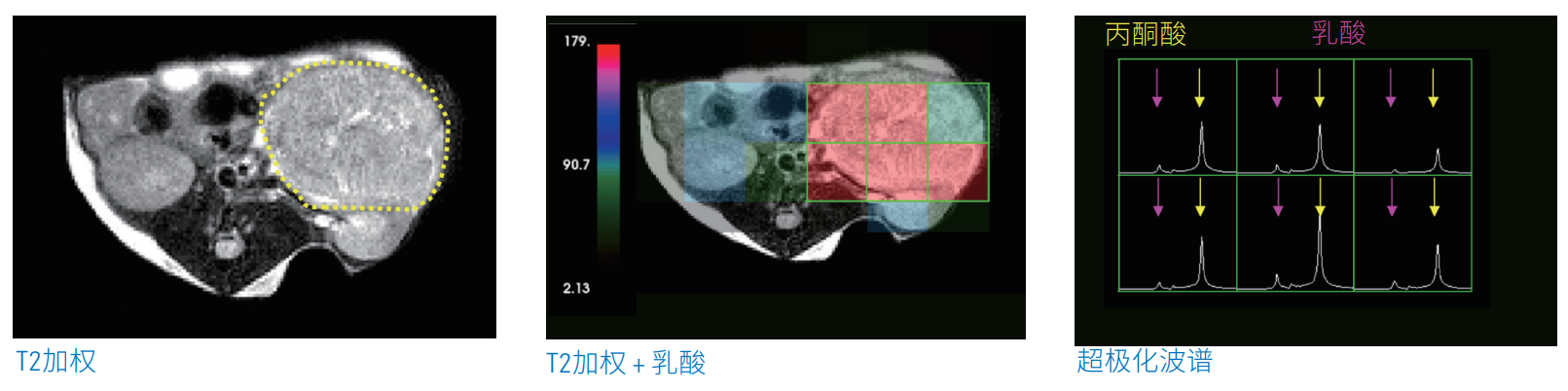 腫瘤學(xué).png 腫瘤學(xué).png