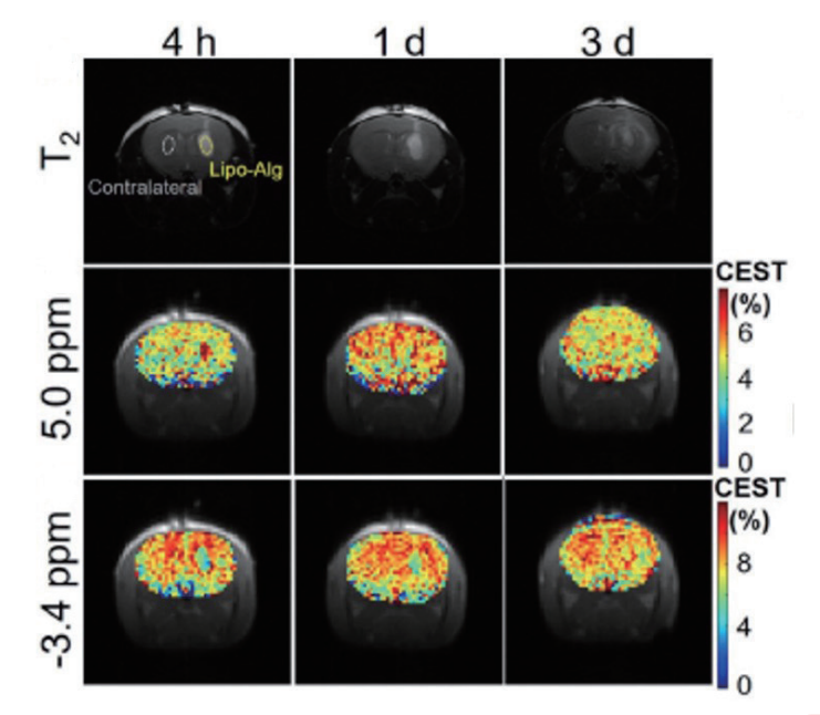藥物開發(fā).png 藥物開發(fā).png